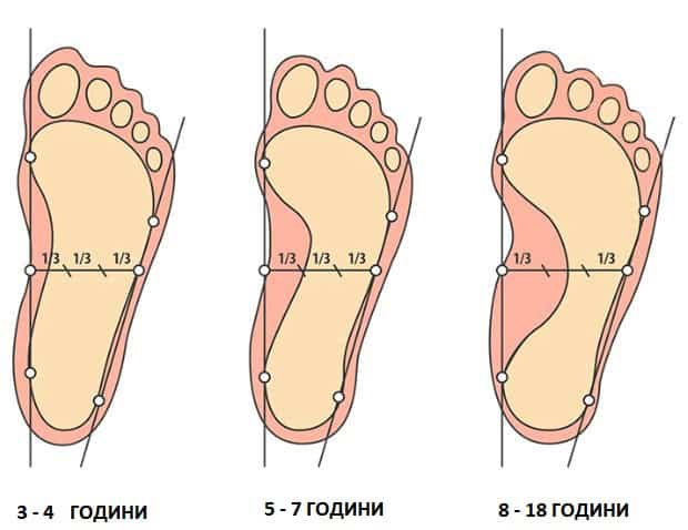 Има ли нужда детето от ортопедични стелки?!